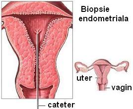 biopsie endometriala